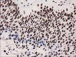 CTDSP1 Antibody in Immunohistochemistry (Paraffin) (IHC (P))