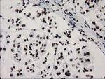 CTDSP1 Antibody in Immunohistochemistry (Paraffin) (IHC (P))