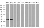 CTDSP1 Antibody in Western Blot (WB)