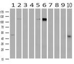 PDE2A Antibody in Western Blot (WB)