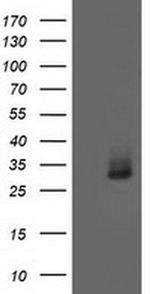 Aquaporin 1 Antibody in Western Blot (WB)