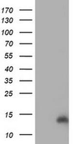 CHCHD5 Antibody in Western Blot (WB)