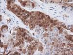 15-PGDH Antibody in Immunohistochemistry (Paraffin) (IHC (P))