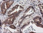 Destrin Antibody in Immunohistochemistry (Paraffin) (IHC (P))