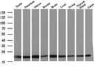 Destrin Antibody in Western Blot (WB)