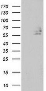 DEF8 Antibody in Western Blot (WB)