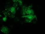 PDLIM2 Antibody in Immunocytochemistry (ICC/IF)