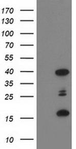 PDLIM2 Antibody in Western Blot (WB)