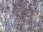 PDLIM2 Antibody in Immunohistochemistry (Paraffin) (IHC (P))