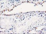 ITM2B Antibody in Immunohistochemistry (Paraffin) (IHC (P))