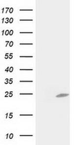 C1orf50 Antibody in Western Blot (WB)