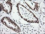 CRY2 Antibody in Immunohistochemistry (Paraffin) (IHC (P))