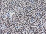 CRY2 Antibody in Immunohistochemistry (Paraffin) (IHC (P))