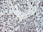 CRY2 Antibody in Immunohistochemistry (Paraffin) (IHC (P))