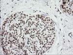 CRY2 Antibody in Immunohistochemistry (Paraffin) (IHC (P))