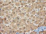 Aldolase B Antibody in Immunohistochemistry (Paraffin) (IHC (P))