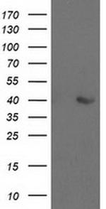 Aldolase B Antibody in Western Blot (WB)