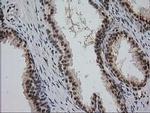 Monoacylglycerol Lipase Antibody in Immunohistochemistry (Paraffin) (IHC (P))