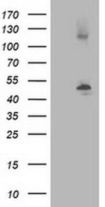 beta-4 Tubulin Antibody in Western Blot (WB)