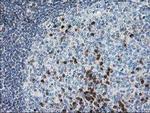 PDXK Antibody in Immunohistochemistry (Paraffin) (IHC (P))