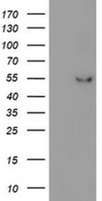 ITFG2 Antibody in Western Blot (WB)