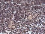 Monoacylglycerol Lipase Antibody in Immunohistochemistry (Paraffin) (IHC (P))