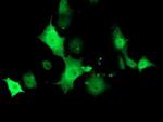 TMOD1 Antibody in Immunocytochemistry (ICC/IF)