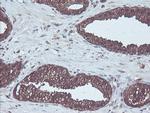 CBR3 Antibody in Immunohistochemistry (Paraffin) (IHC (P))