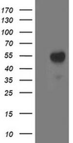 Aminoacylase Antibody in Western Blot (WB)