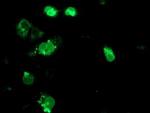 TRAP alpha Antibody in Immunocytochemistry (ICC/IF)