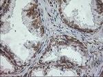 TRAP alpha Antibody in Immunohistochemistry (Paraffin) (IHC (P))