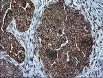 TRAP alpha Antibody in Immunohistochemistry (Paraffin) (IHC (P))