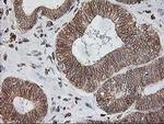 TRAP alpha Antibody in Immunohistochemistry (Paraffin) (IHC (P))