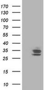 TRAP alpha Antibody in Western Blot (WB)