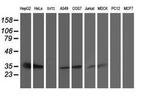 TRAP alpha Antibody in Western Blot (WB)