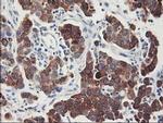 FDFT1 Antibody in Immunohistochemistry (Paraffin) (IHC (P))