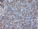 Ribophorin I Antibody in Immunohistochemistry (Paraffin) (IHC (P))