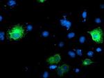 Ribophorin I Antibody in Immunocytochemistry (ICC/IF)