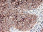 Ribophorin I Antibody in Immunohistochemistry (Paraffin) (IHC (P))