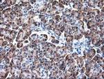 Ribophorin I Antibody in Immunohistochemistry (Paraffin) (IHC (P))