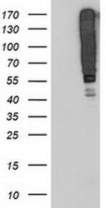 SERPINB13 Antibody in Western Blot (WB)