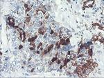 SERPINB2 Antibody in Immunohistochemistry (Paraffin) (IHC (P))