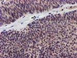 KVbeta1 (KCNAB1) Antibody in Immunohistochemistry (Paraffin) (IHC (P))