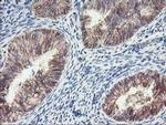 ALOX15 Antibody in Immunohistochemistry (Paraffin) (IHC (P))