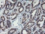 ALOX15 Antibody in Immunohistochemistry (Paraffin) (IHC (P))