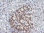 CD249 Antibody in Immunohistochemistry (Paraffin) (IHC (P))