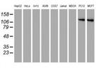 CD249 Antibody in Western Blot (WB)