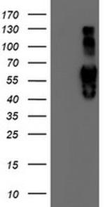Iduronate 2 Sulfatase Antibody in Western Blot (WB)
