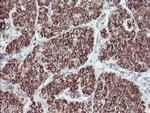 PECI Antibody in Immunohistochemistry (Paraffin) (IHC (P))