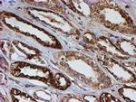 PSMB9 Antibody in Immunohistochemistry (Paraffin) (IHC (P))